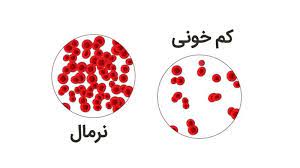 پاورپوینت در مورد کم خونی  ناشی  از    فقر  آهن و سایر کم خونی های  تغذیه ایی